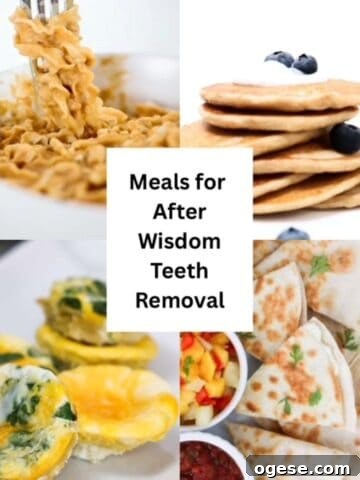 Meals for After Wisdom Teeth Removal